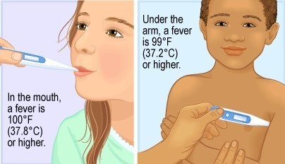 Fever